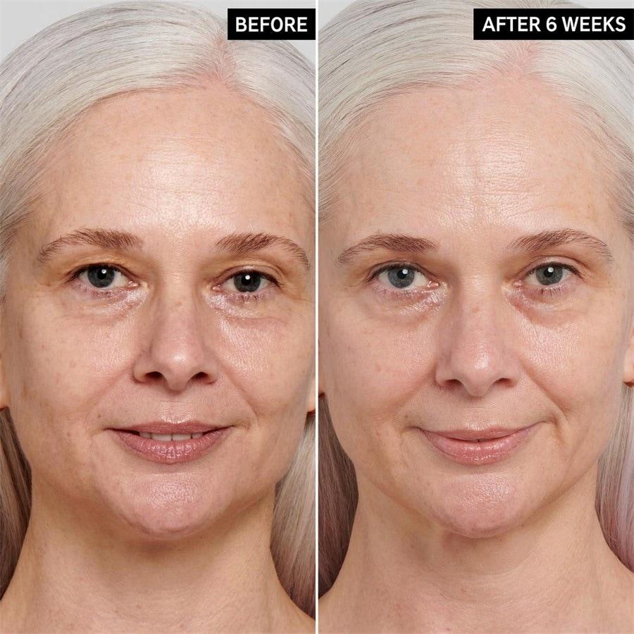 The INKEY List Sieri Retinol Serum Vendite Flash