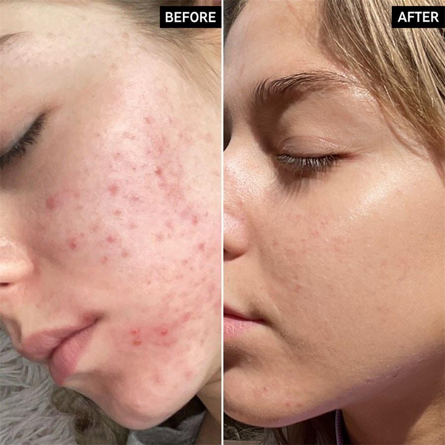 The INKEY List Sieri Niacinamide Serum Vendita calda