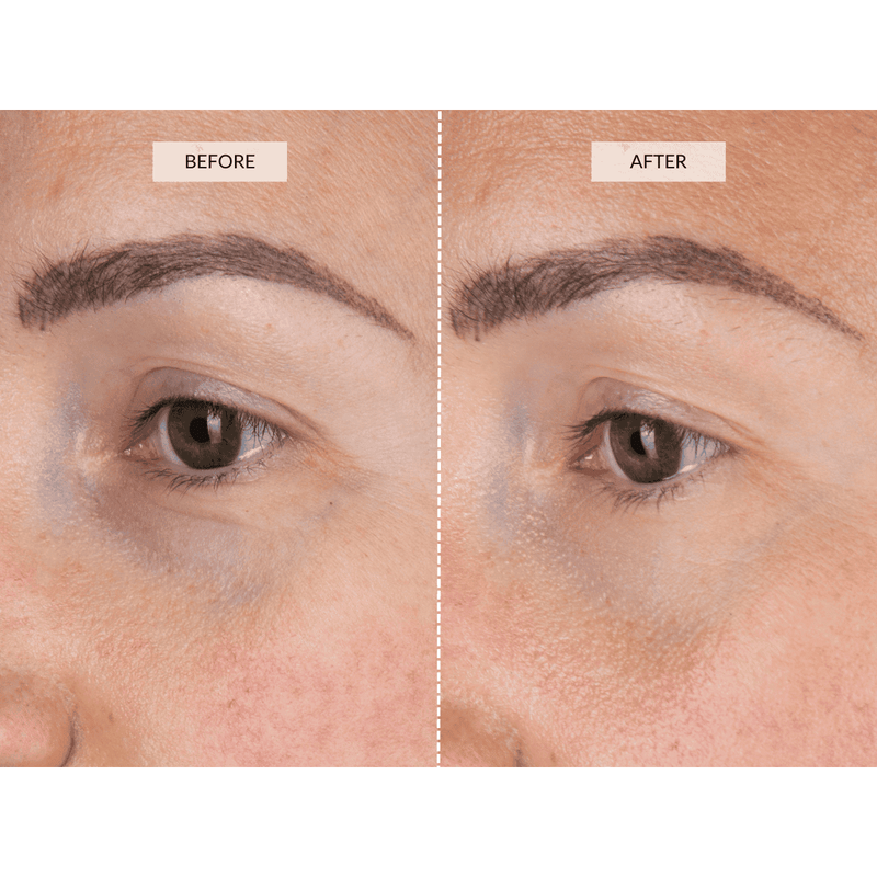 CurrentBody Skin LED Eye Perfector Promozione Limitata
