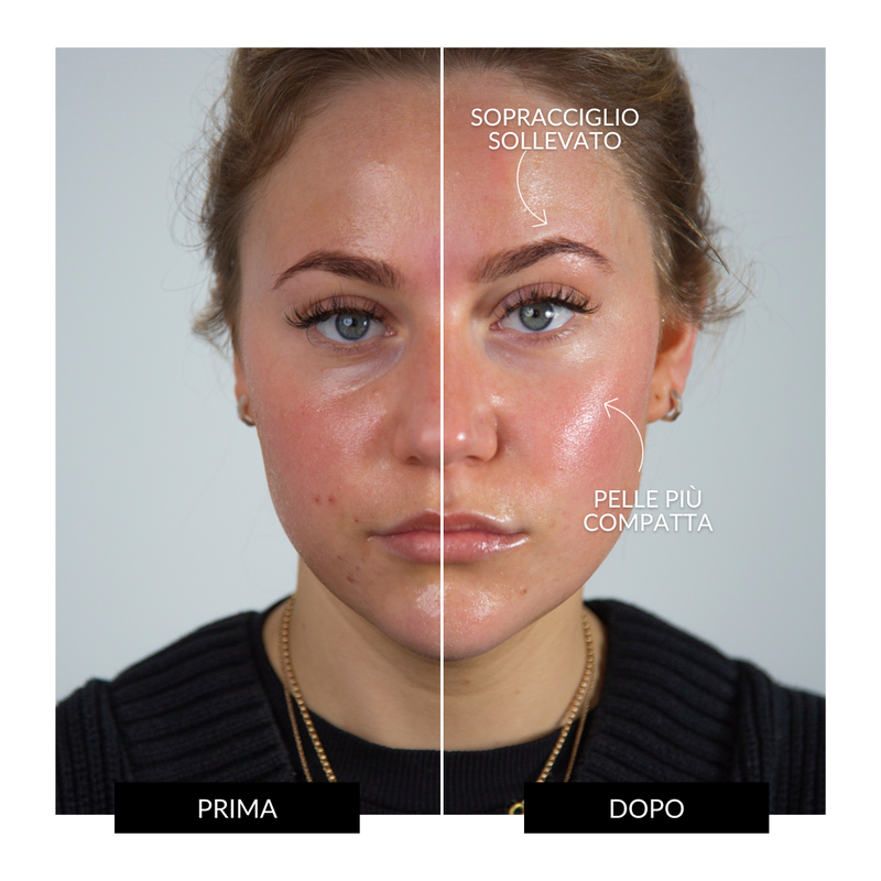 ZIIP Dispositivo Tonificante Viso HALO Prezzo Ridotto