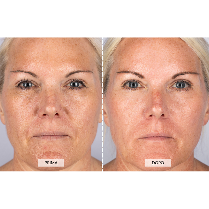 CurrentBody Skin Dispositivo a radiofrequenza per il viso RF Currentbody Skin Presa