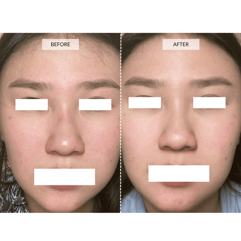 CurrentBody Skin Maschera viso LED 4-in-1 con mappatura a zone Currentbody Skin Outlet