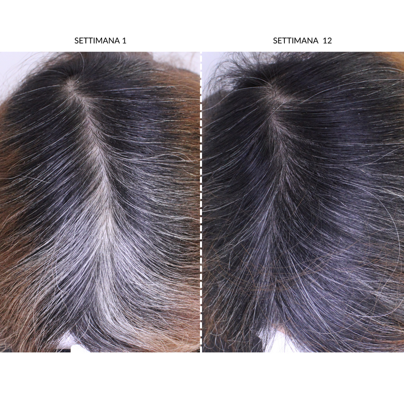 CurrentBody Skin Dispositivo LED Per la Ricrescita dei Capelli Saldi
