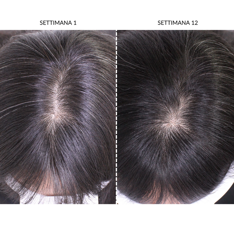 CurrentBody Skin Dispositivo LED Per la Ricrescita dei Capelli Saldi