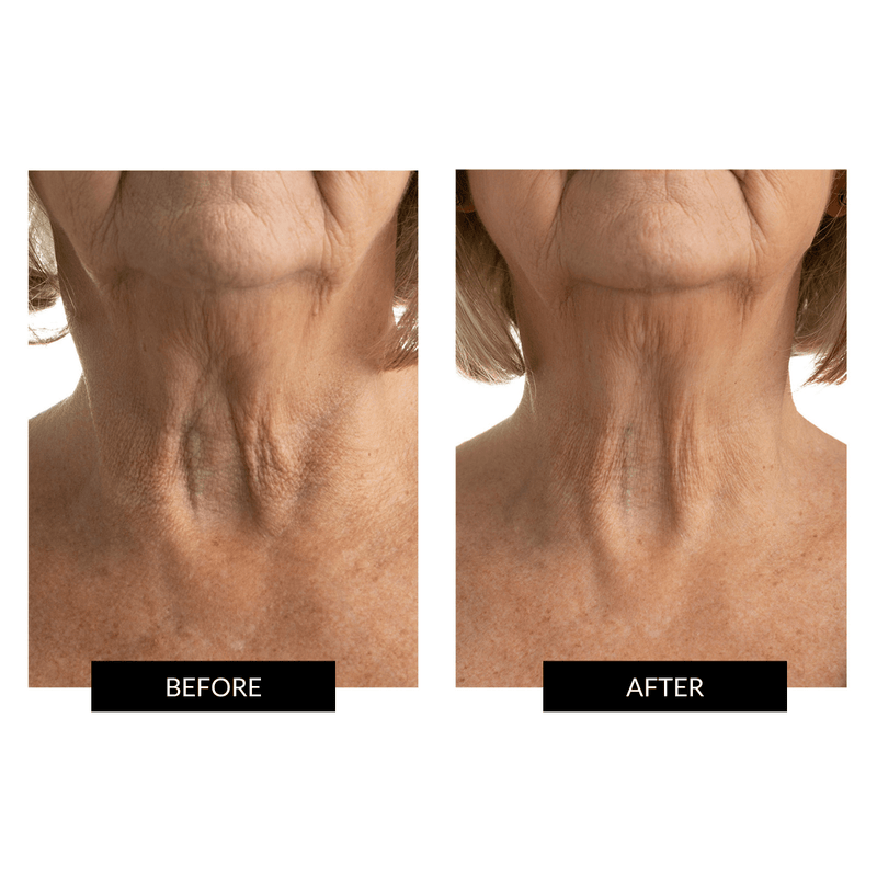 CurrentBody Skin Maschera Collo e Décolleté Hotsell