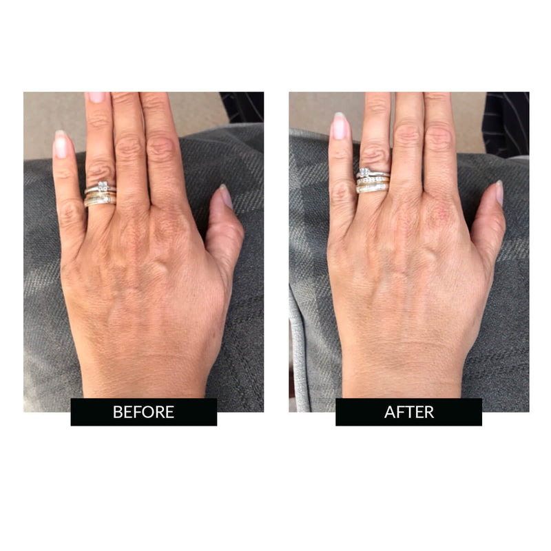 CurrentBody Skin Offers CurrentBody Skin LED Hand Perfector Offerta Nuova