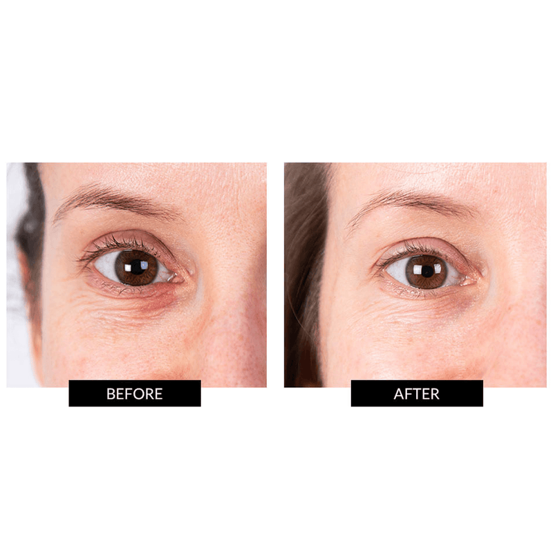 CurrentBody Skin LED Eye Perfector & 5 Eye Hydrogel Masks (del valore di 249€) Promozione