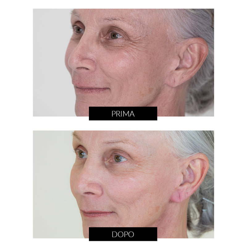 Nira Skin CurrentBody Exclusive Vendita Economica