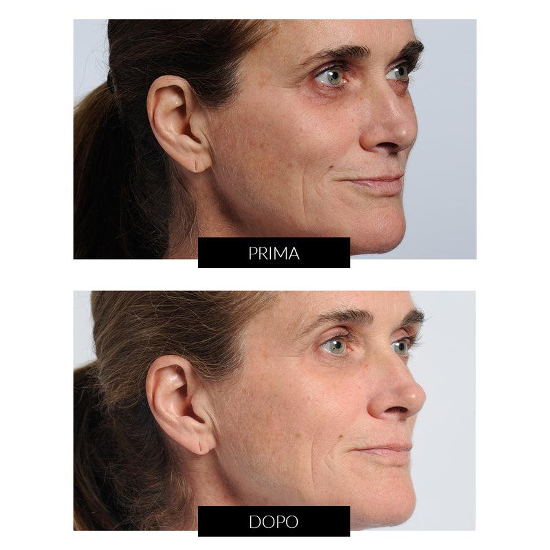Nira Skin CurrentBody Exclusive Vendita Economica