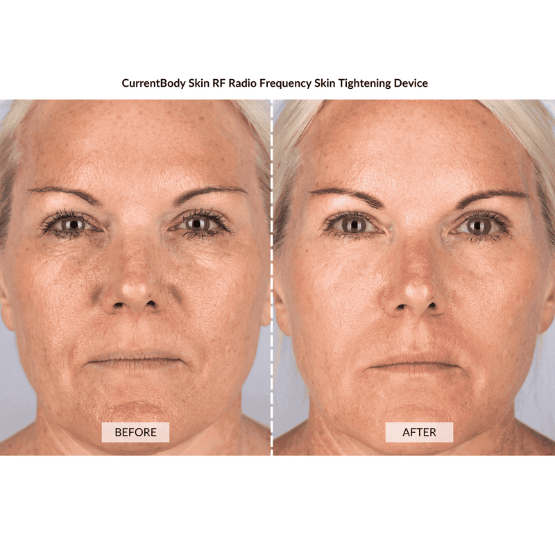 CurrentBody Skin Kit Viso Anti-età completo Convenienza