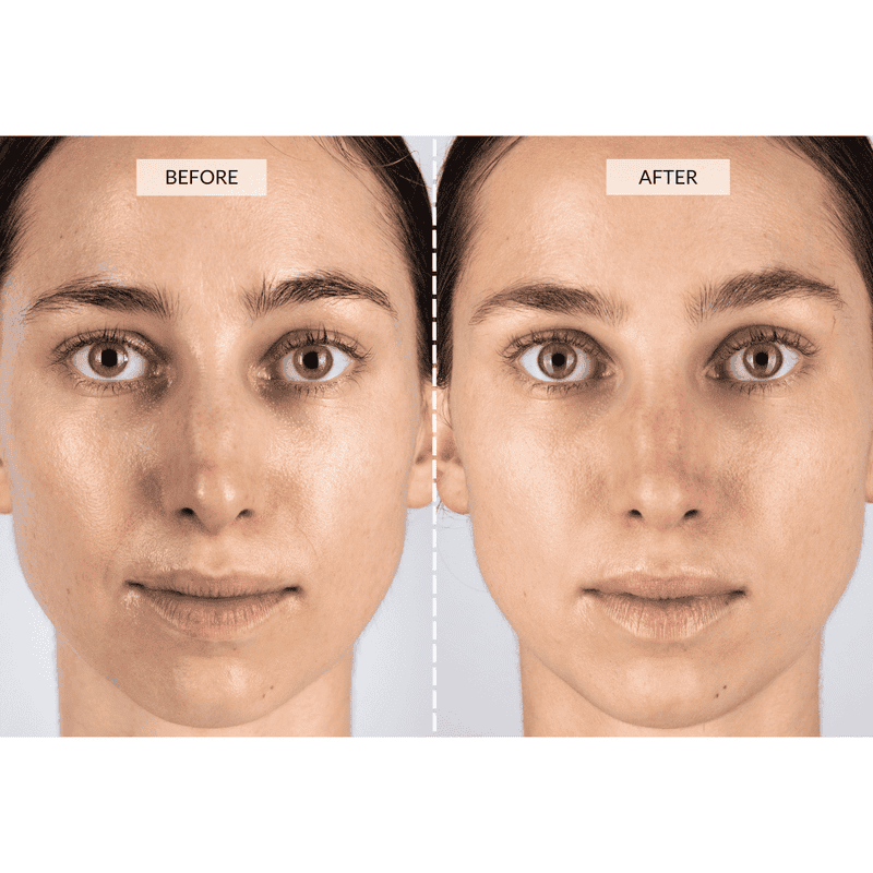 CurrentBody Skin Set Regalo Beauty LED In Linea