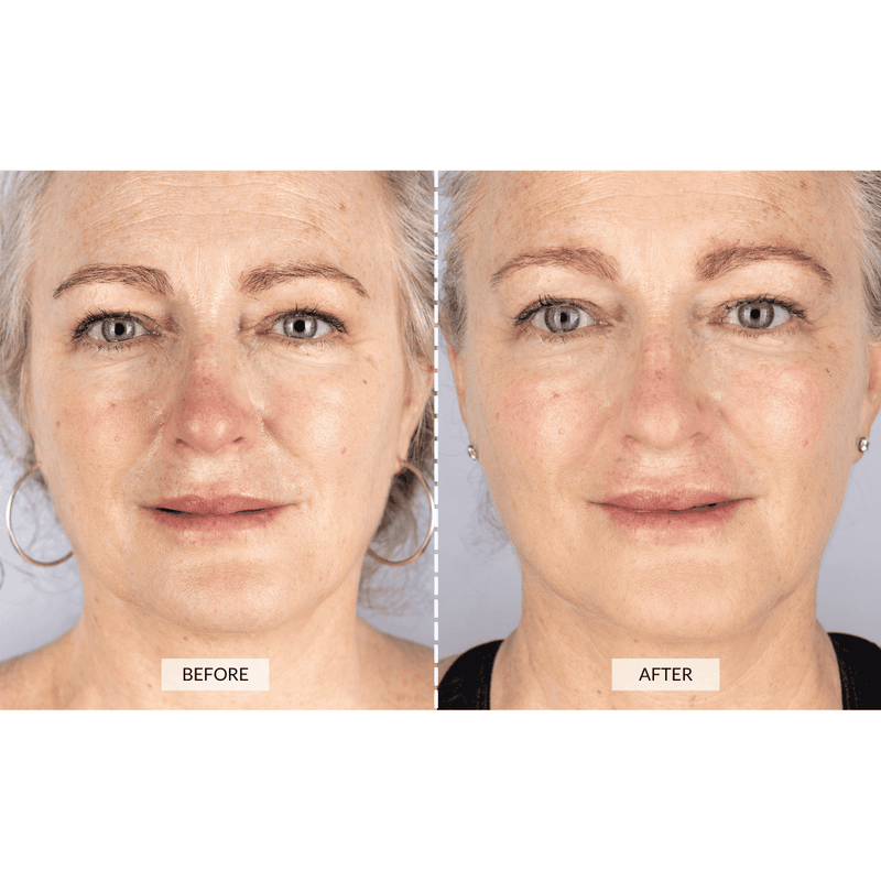 CurrentBody Skin Set Regalo Beauty LED In Linea