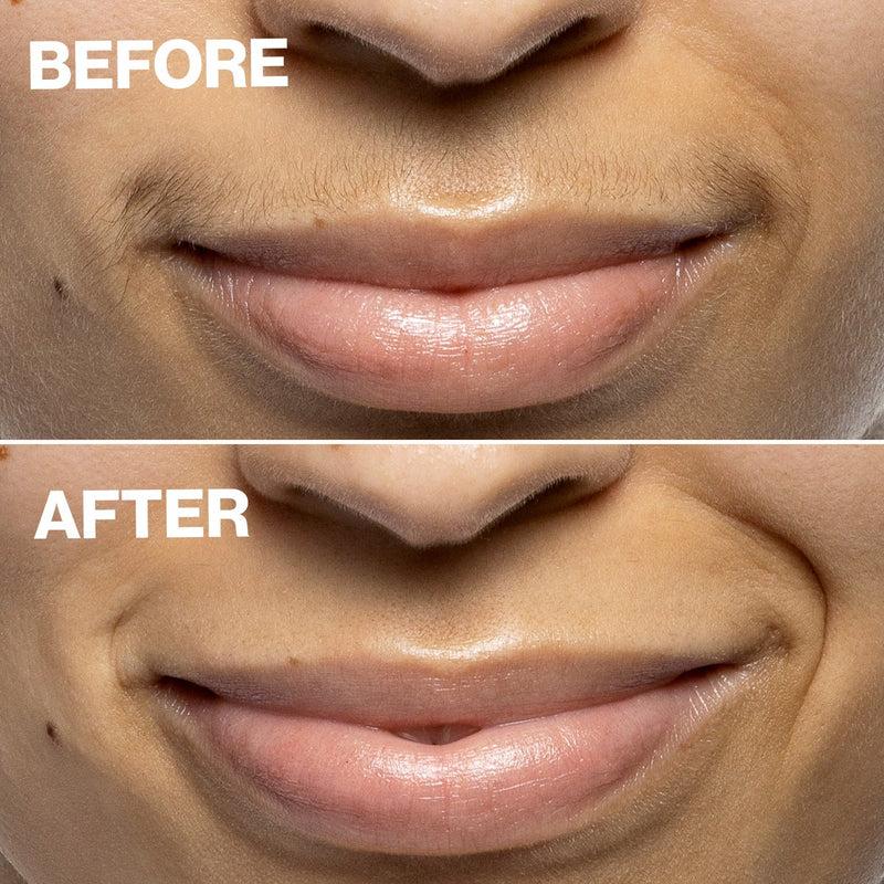 DERMAFLASH Dispositivo di Epilazione Mini Precision Peach Fuzz Qualità Garantita