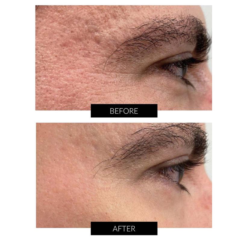 Dr Levy Set Stem Cell Miracle Trial (del valore di 495€) I Più Venduti