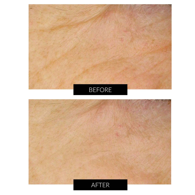Dr Levy Set Stem Cell Miracle Trial (del valore di 495€) I Più Venduti