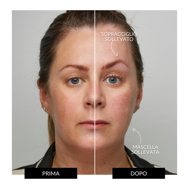 CurrentBody Skin Offers Dispositivo Tonificante Facciale ZIIP HALO Offerta Consegna Veloce