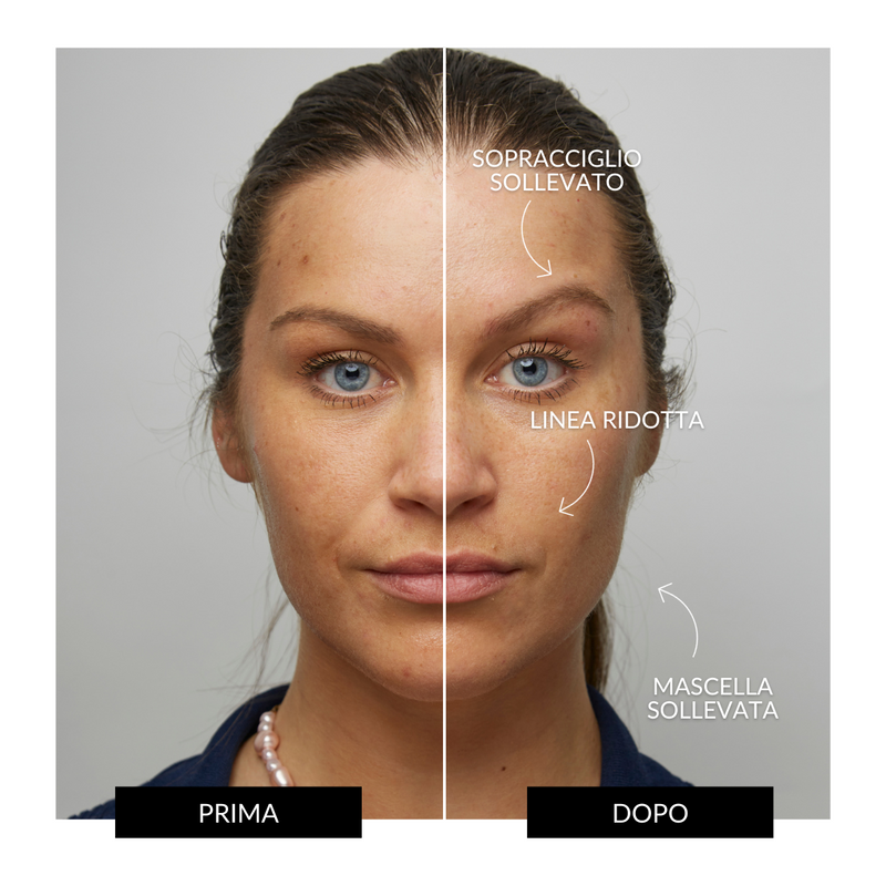 CurrentBody Skin Offers Dispositivo Tonificante Facciale ZIIP HALO Offerta Consegna Veloce