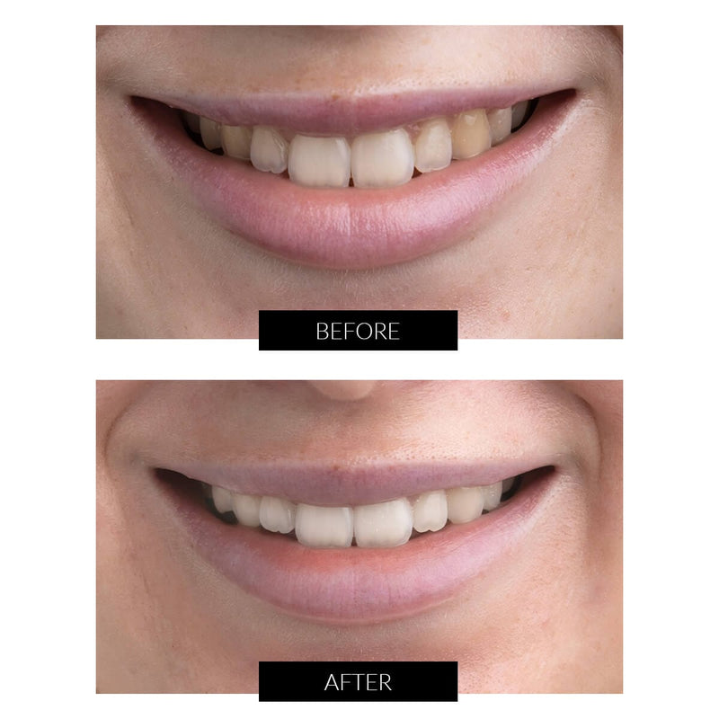 CurrentBody Skin Offers CurrentBody Skin Kit Sbiancamento Denti LED Offerta Italy
