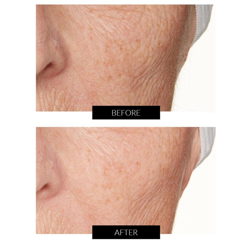 Lancer Skincare The Method: Nourish Normal-Combination Skin (50ml) Qualità Garantita