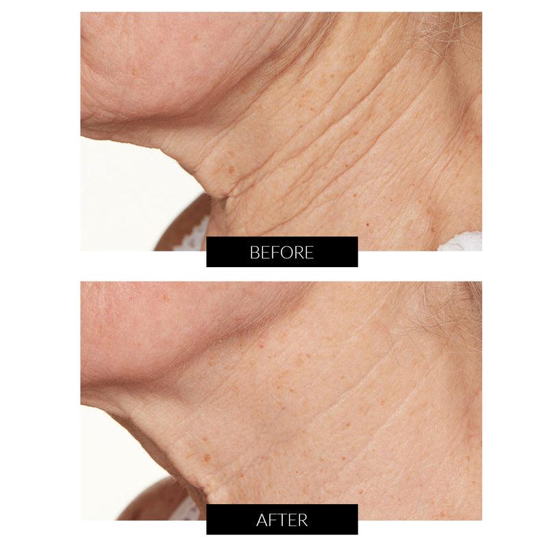 Lancer Skincare Trattamento Notte Intensivo con Hylaplex e Olio di Marula (50ml) Convenienza
